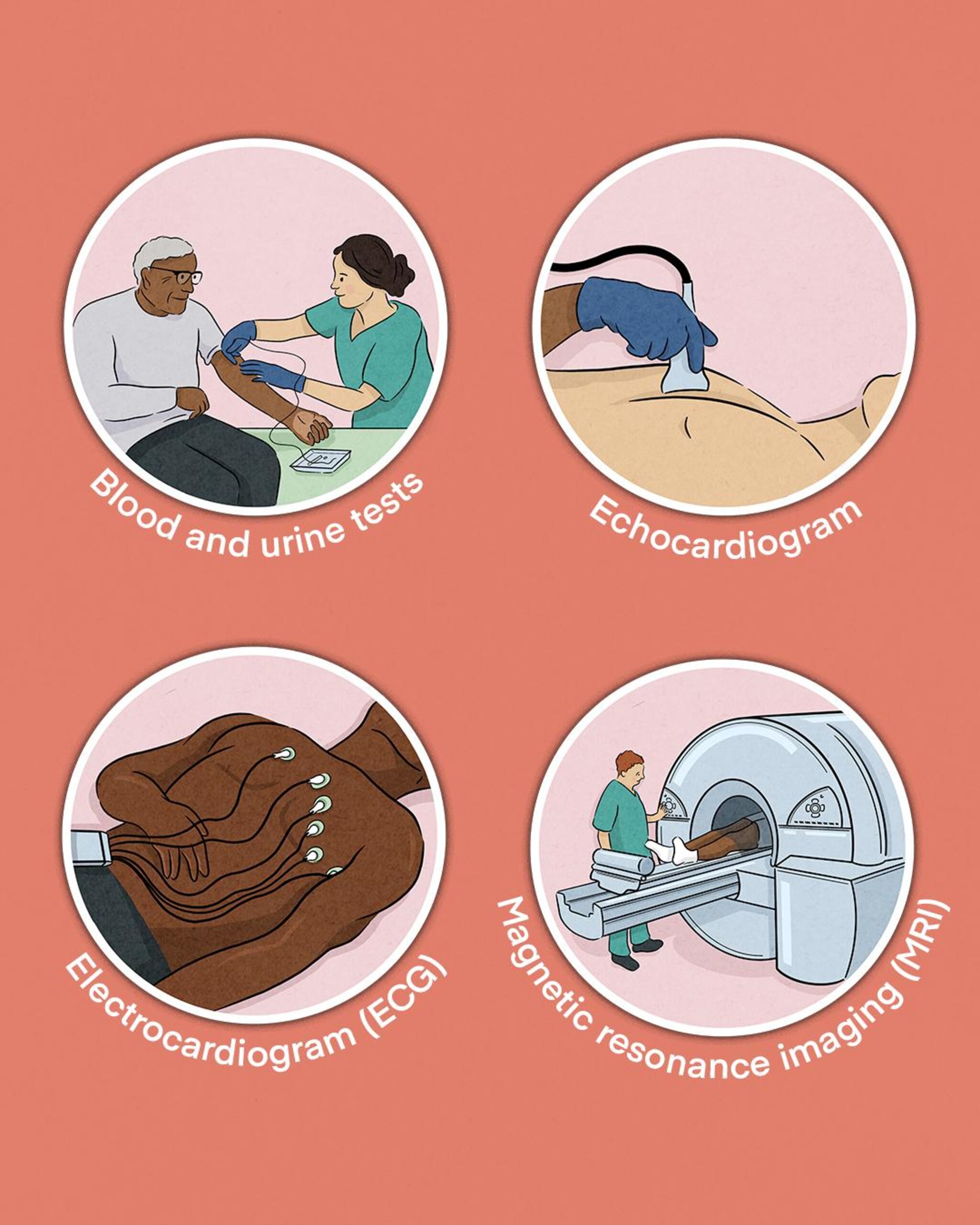 Each test provides different clues that point to ATTR-CM. Blood and urine tests measure protein levels. An ECG can reveal weaker electrical signals in the heart. An echocardiogram can show thickening of the heart walls, while an MRI scan may show scarring or damage to the heart walls.